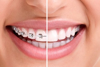 Orthodontie