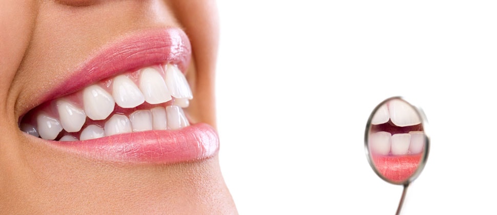 Smile-Design