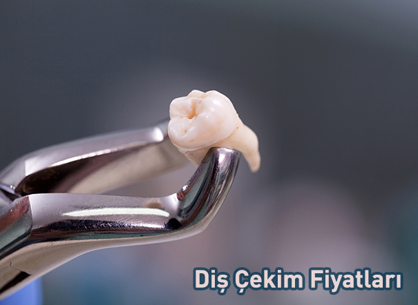 Türk Diş Hekimleri Birliği Tarafından Belirlenen Diş Çekim Fiyatları