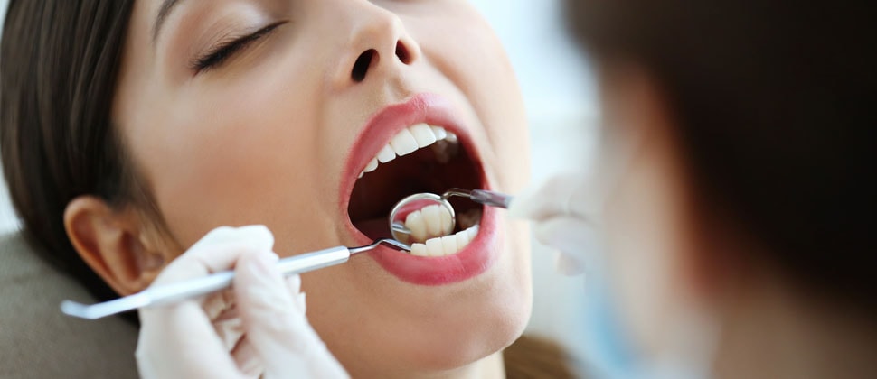 Periodontal Tedavi