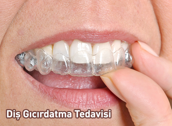 Diş Gıcırdatma Tedavisi Fiyatları 2018