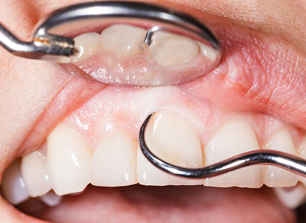 Periodontal Tedavileri Kimler Yapar?